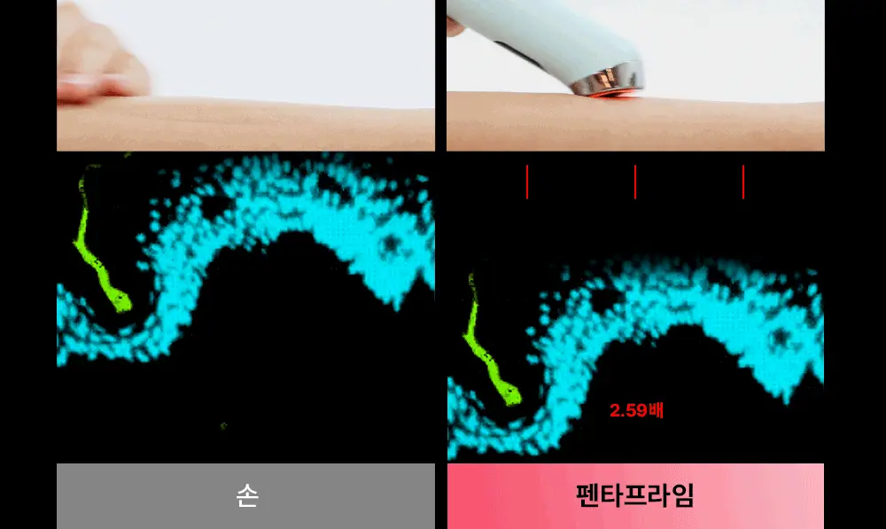 [광채개선] 마미케어 펜타프라임 5종 중 택 1 (기획/단품) 상세페이지 25